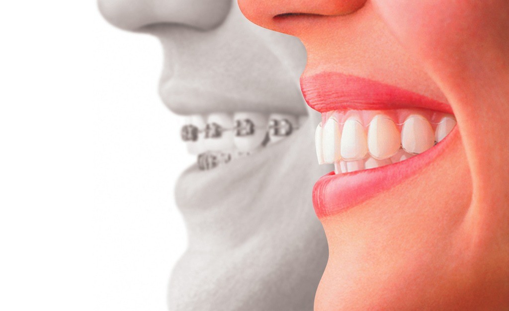 cosmetic dentist quotes columbia sc